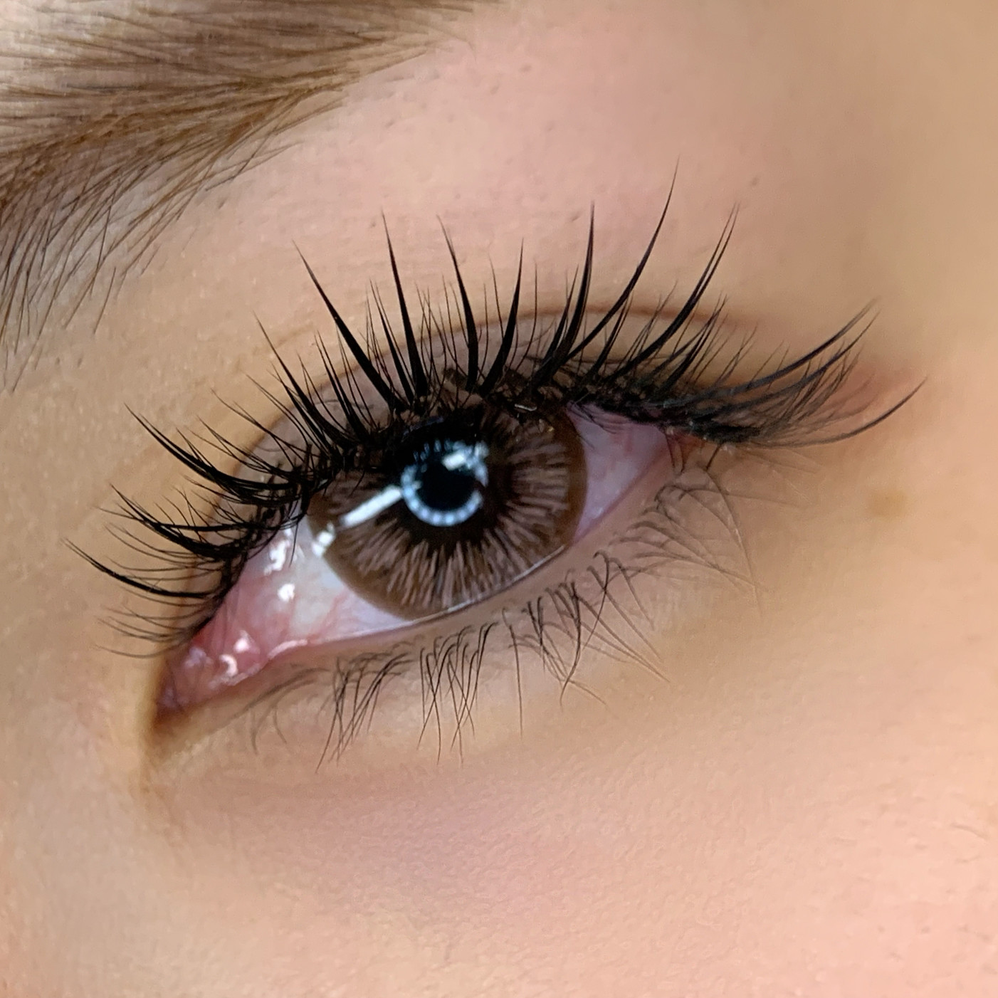 Beauty treatment result 2