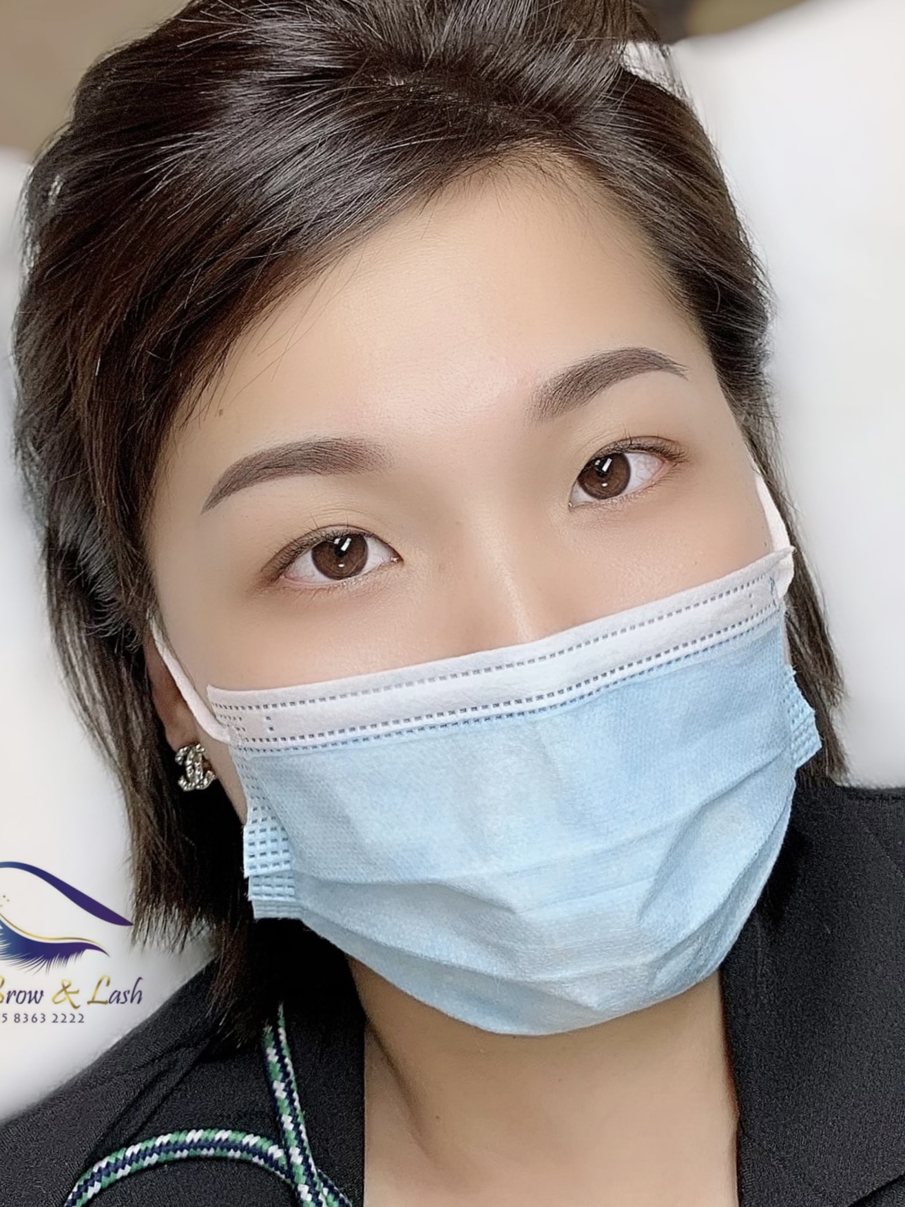 Beauty treatment result